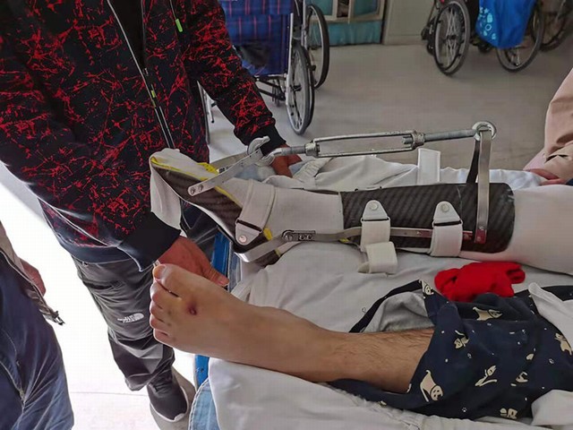 跟腱萎缩锻炼支具