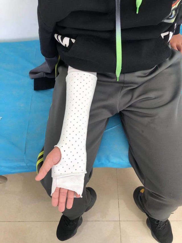 腕部低温（休息位固定）