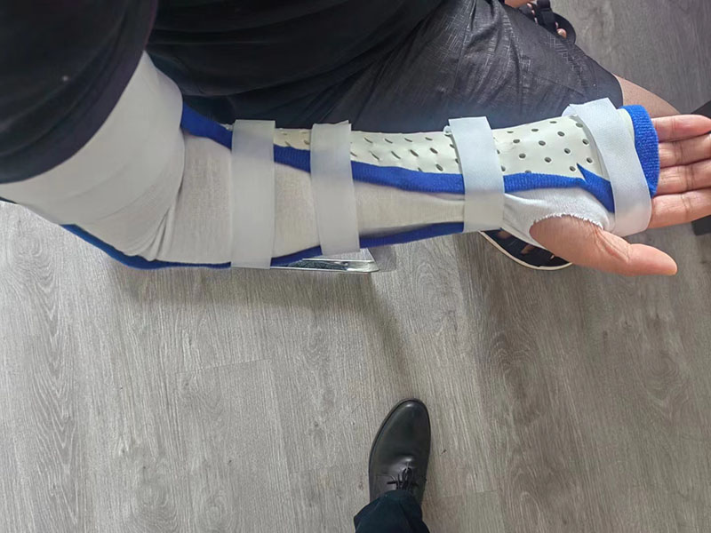 肘关节低温（旋后位固定）