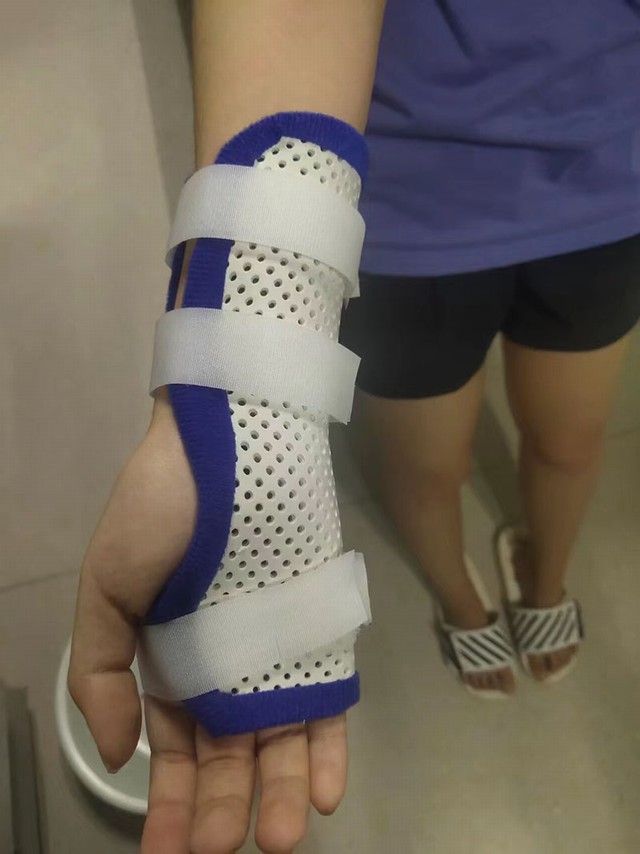 腕部低温（第五掌骨骨折）