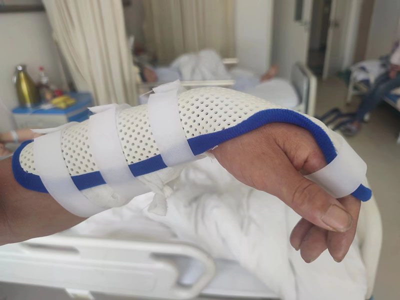 腕部低温（克雷氏骨折）