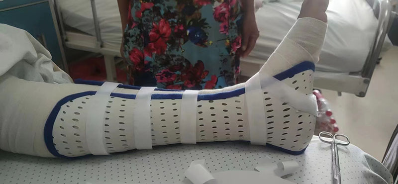 踝足低温（跟骨损伤）